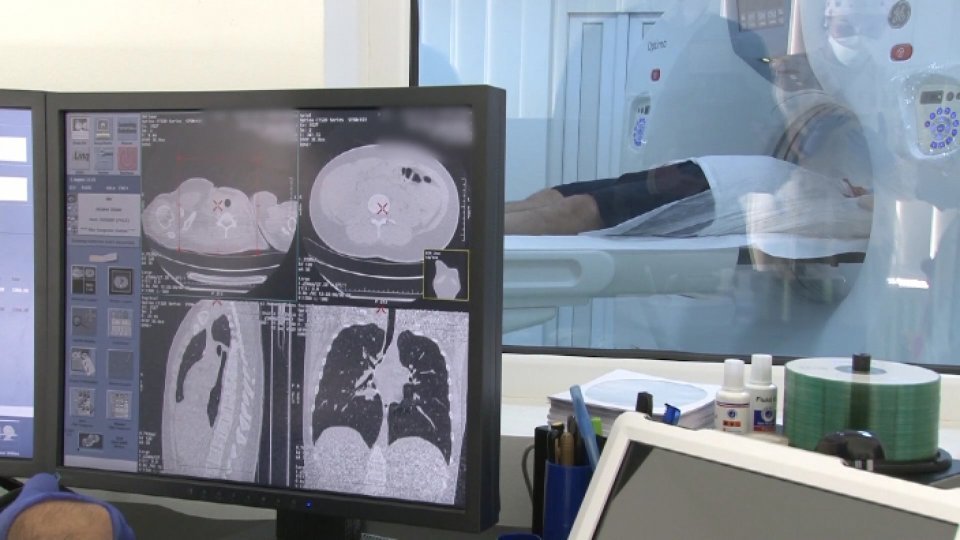 Peste 100.000 de români sunt diagnosticaţi anual cu cancer